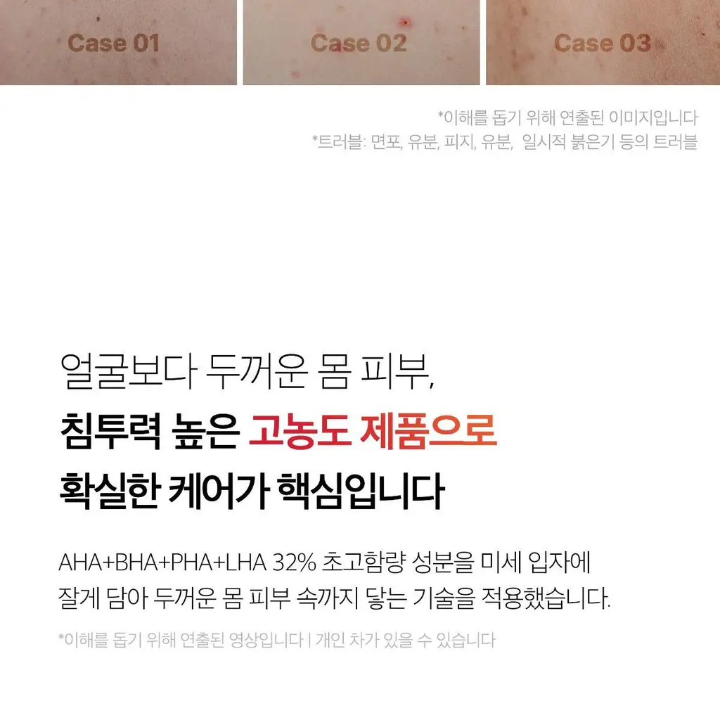 [NEW/바디트러블 케어] 메디큐브 레드 아크네 바디 필링 샷 110g 상세페이지 8
